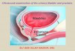 Presentation1.pptx, ultrasound examination of the urinary bladder and prostate
