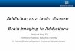 Addiction as a brain disease Brain Imaging in Addictions