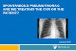 Spontaneous pneumothorax: Are we treating the patient or the xray?
