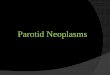 Parotid Neoplasm