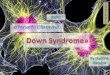  Genetic deseases. Down syndrome