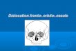 Dislocation fronto-orbito-nasale