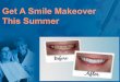 Get A Smile Makeover This Summer
