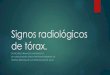 signos radiologicos de torax