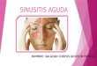 Sinusitis aguda A