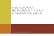 Neurotoxina botulínica tipo a y hemiparesia facial