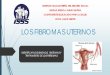 Los fibromas uterinos