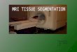 MRI Tissue Segmentation using MICO