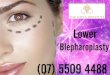 Lower Blepharoplasty (Eyelid Surgery) Gold Coast - Southport Clinic