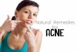 Natural remedies for acne