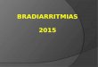 Bradiarritmias 2015