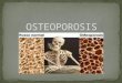 Osteoporosis y Enfermedad de Paget