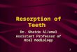 Teeth Resorption
