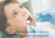 How to select a dental clinic in delhi for your dental implants
