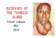 03. diseases of thyroid gland