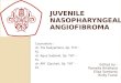 PPT Journal Juvenile Nasopharynx Angiofibroma