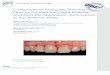 Composite in Everyday Practice- How to Choose the Right Material and Simplify Application Techniques in the Anterior Teeth
