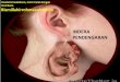 Tentir Anatomi Indera Pendengaran Dan Penghidu