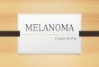 Melanoma y radiacion solar (Histofisiopatologia)