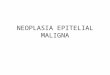 Neoplasia Epitelial Maligna