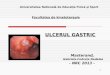 Ulcerul Gastric