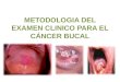 Metodologia Del Examen Clinico Para El Cancer Bucal