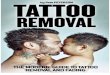 Tattoo Removal_ the Modern Guide to Tatt - Peterson Pete