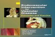Endovascular intervention for vascular disease