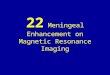 22 meningeal enhancement on magnetic resonance imaging