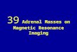 39 adrenal masses on magnetic resonance imaging