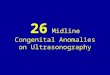 26 midline congenital anomalies on ultrasonography