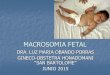 1- Macrosomia Fetal