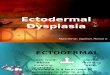 Ectodermal Dysplasia-