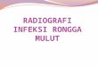 Radiografi Infeksi Rongga Mulut