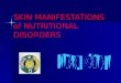 Skin Manifestation of Nutritional Disorders