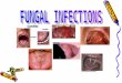 FUNGAL INFECTIONS The fungal infections of the oral mucosa most frequently occurred due to species of Candida. Candida is present as acommensal organism