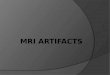 Introduction  There are numerous kinds of artifacts that can occur in MRI.  Some effect the quality of the MRI exam.  Others may be confused with pathology