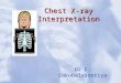 Chest X-ray Interpretation Dr C. Lokubalasooriya