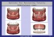 Gerald A. Niznick DMD, MSD 1 Options for Restoring Totally Edentulous Jaws