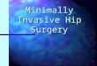 Minimally Invasive Hip Surgery. Introduction Many people suffering from arthritis alter their lives to deal with pain. Many people suffering from arthritis