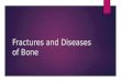 Fractures and Diseases of Bone. Fractures