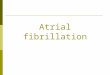 Atrial fibrillation. What is it?  AF is an arrhythmia is which electrical activity in the atria is disorganised  The AV node receives more electrical