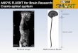 ANSYS FLUENT for Brain Research: Cranio-spinal system Medical ImageMathematical Model Cranium Spinal canal