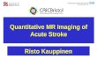 Quantitative MR Imaging of Acute Stroke Risto Kauppinen
