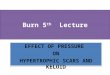 Burn 5 th Lecture EFFECT OF PRESSURE ON HYPERTROPHIC SCARS AND KELOID EFFECT OF PRESSURE ON HYPERTROPHIC SCARS AND KELOID