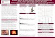 Proteomic Analysis of Ocular Discharges and Plasma From Patients with Stevens Johnson Syndrome/Toxic Epidermal Necrolysis Julia Malalis, Christine Mata,