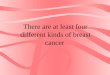 There are at least four different kinds of breast cancer