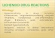 Etiology  Hypersensitivity to drugs including sulfasalazine, angiotensinconverting enzyme inhibitors, nonsteroidal anti-inflammatory drugs, β-blockers,