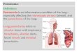 Pneumonia: Definition: Pneumonia is an inflammatory condition of the lung— especially affecting the microscopic air sacs (alveoli), and the parenchyma