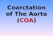 Coarctation of The Aorta (COA).  5 – 7 % of CHD.  Constriction of the Aorta of varying degree which may occur at any point from the transverse arch